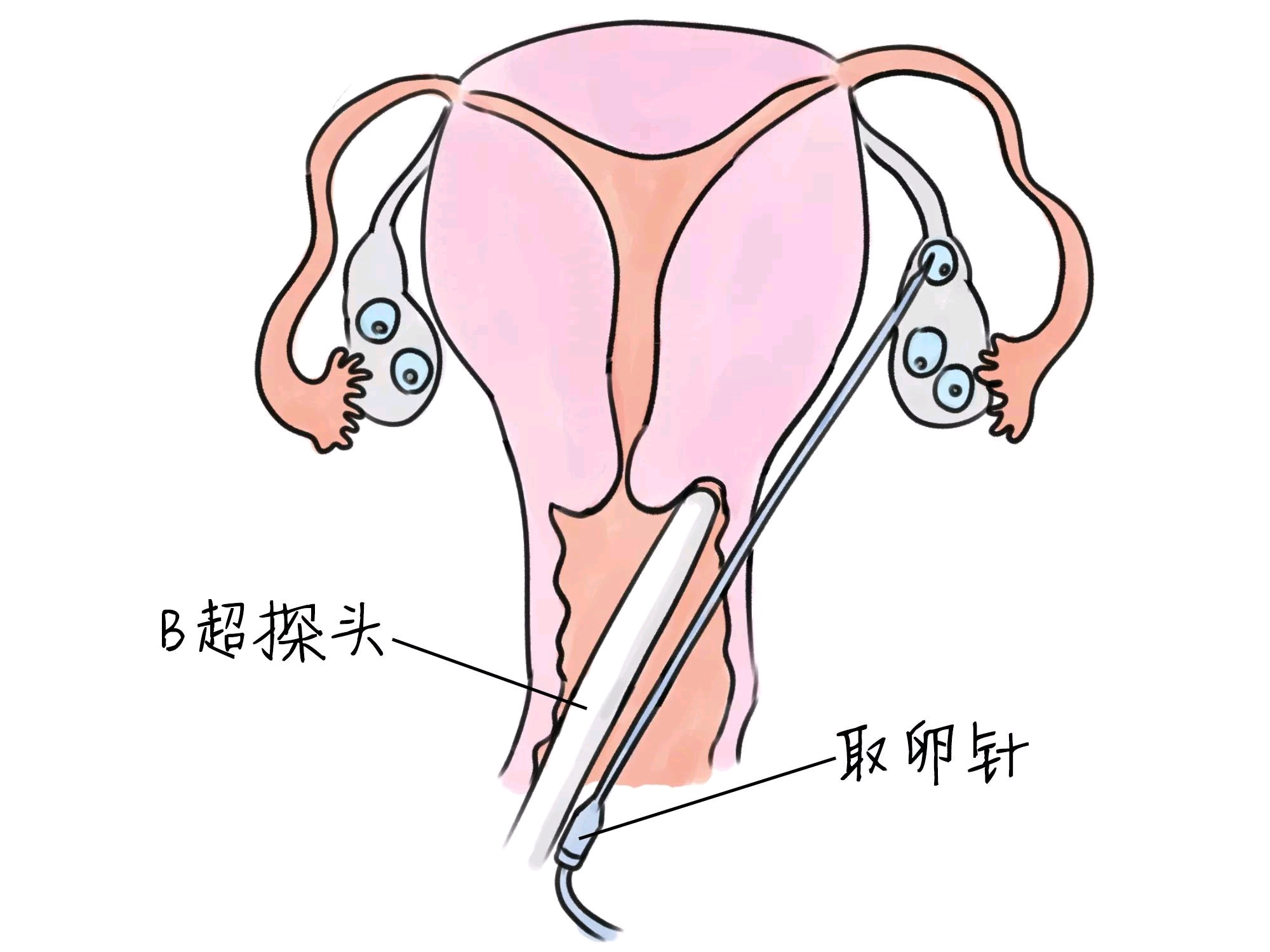 二次元人物怀孕