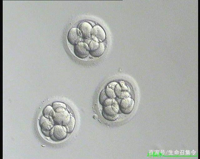 产前准备