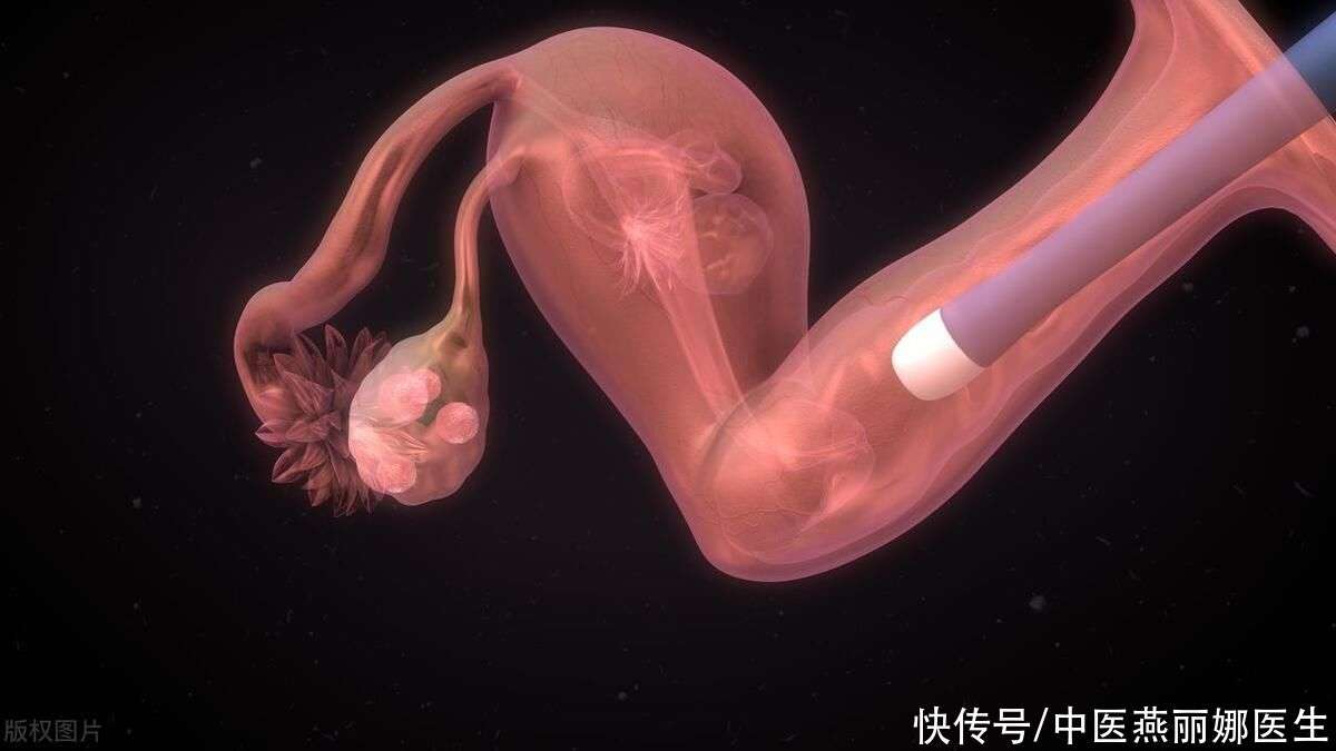 二胎臀位