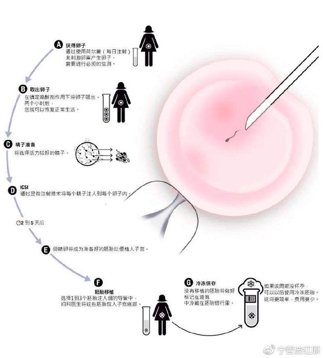 产妇