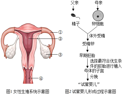 产后妊娠纹