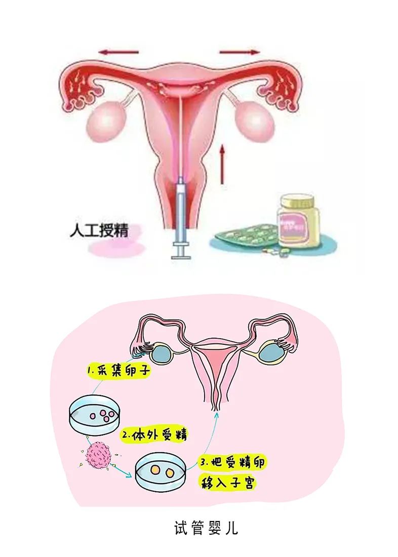 二胎胎位不正