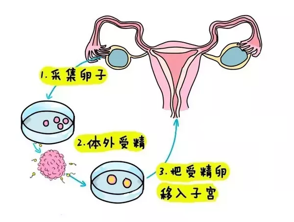妊娠纹