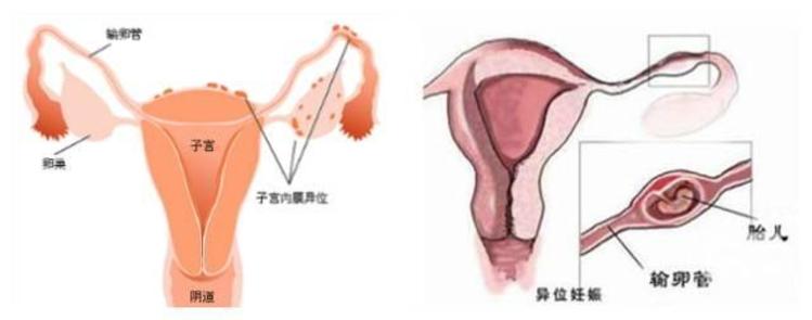 早早孕试纸