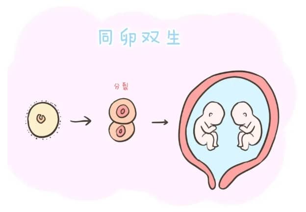非洲妇女早产