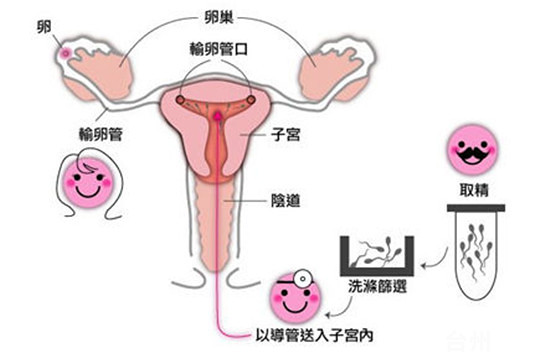 捐卵供卵机构